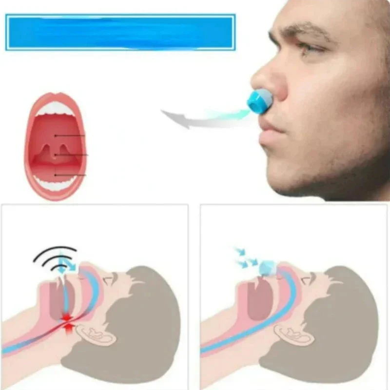 2-in-1 Anti Snore Device and Air Purifier Nose Clip - Image 2