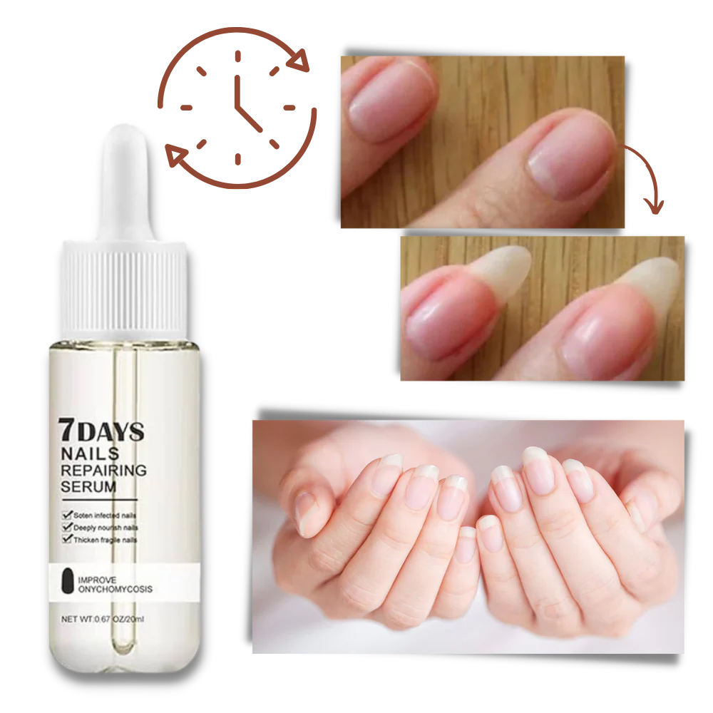 7 Days Nail Repair Essence - Image 5