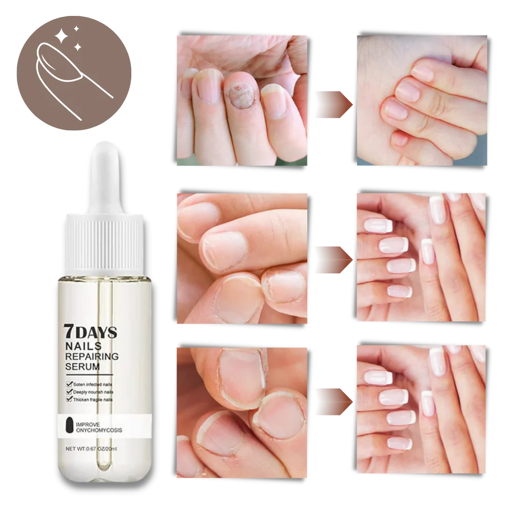 7 Days Nail Repair Essence - Image 7