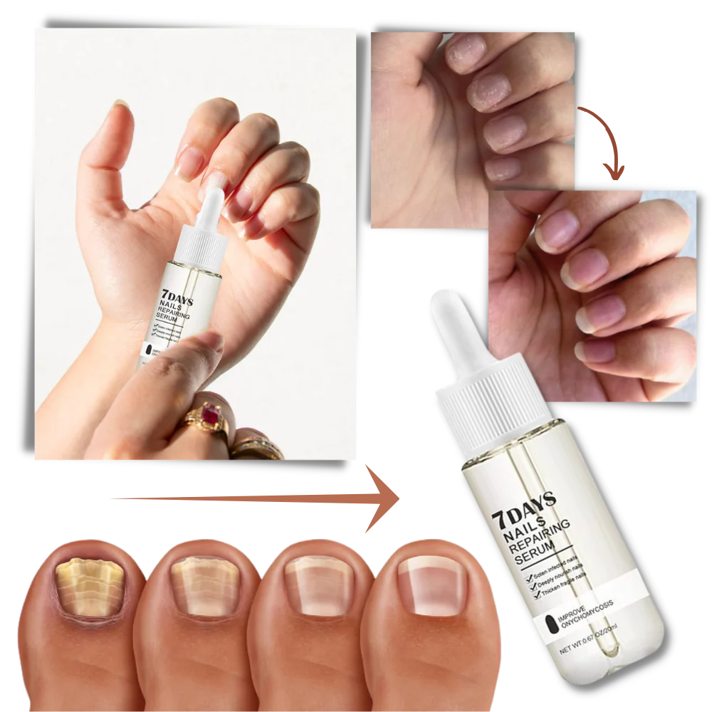 7 Days Nail Repair Essence - Image 8