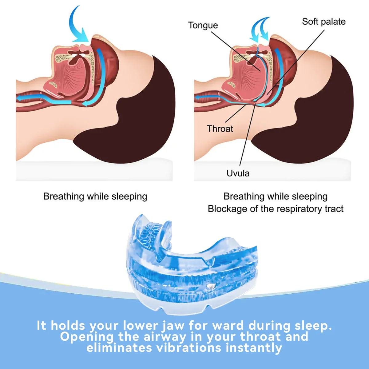 Adjustable Anti Snore Mouthpiece - Image 3