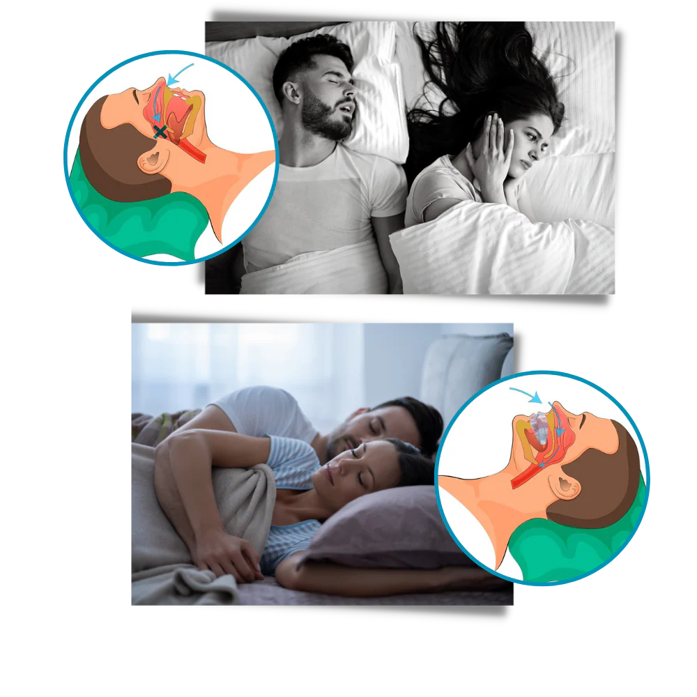 Advanced anti-snoring device - Image 3