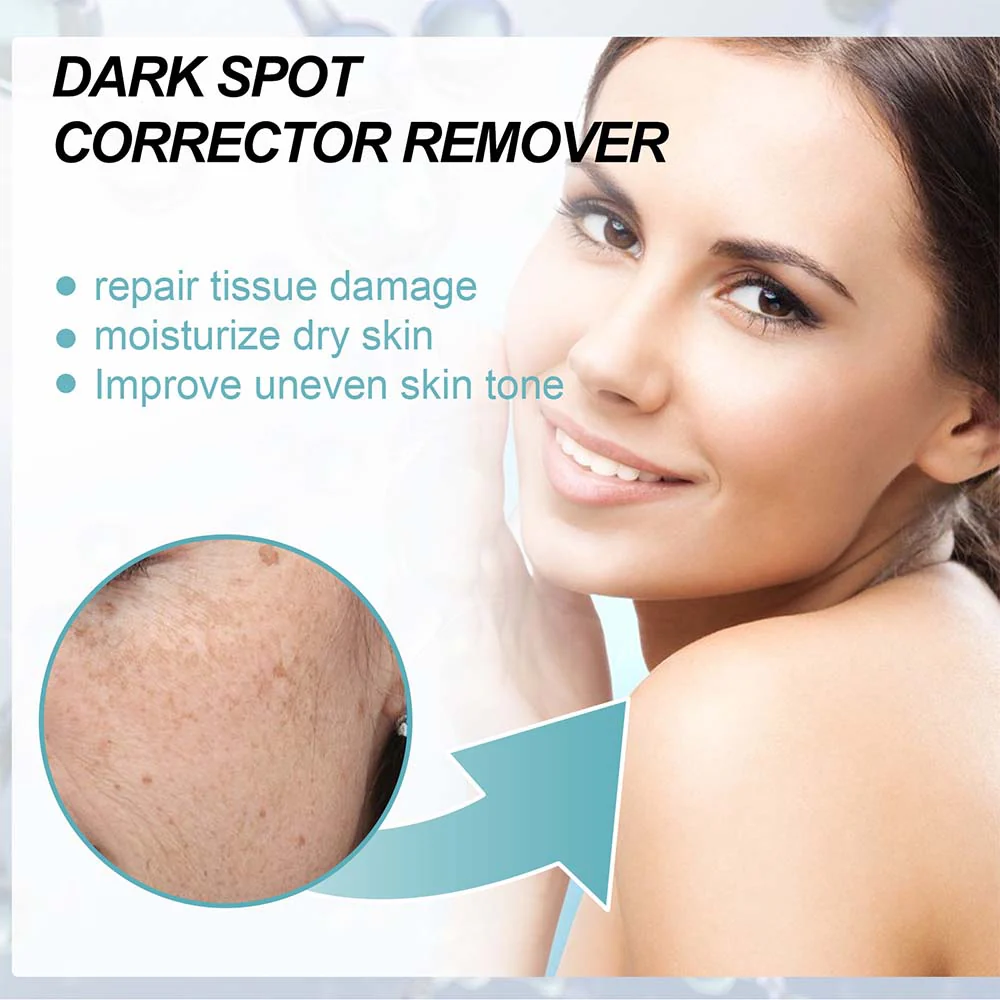 Anti-Dark Spot Skin Care Lightens Pigmentation Spots - Image 5