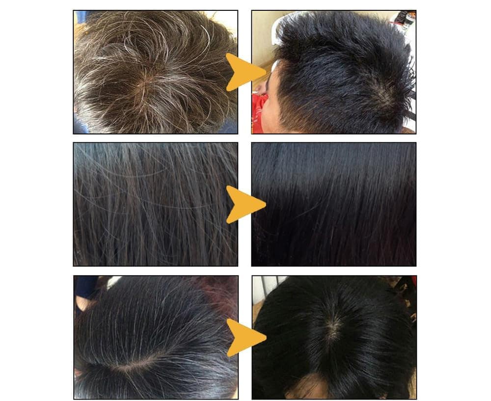Anti-Gray Hair Shampoo Treatment - Image 2