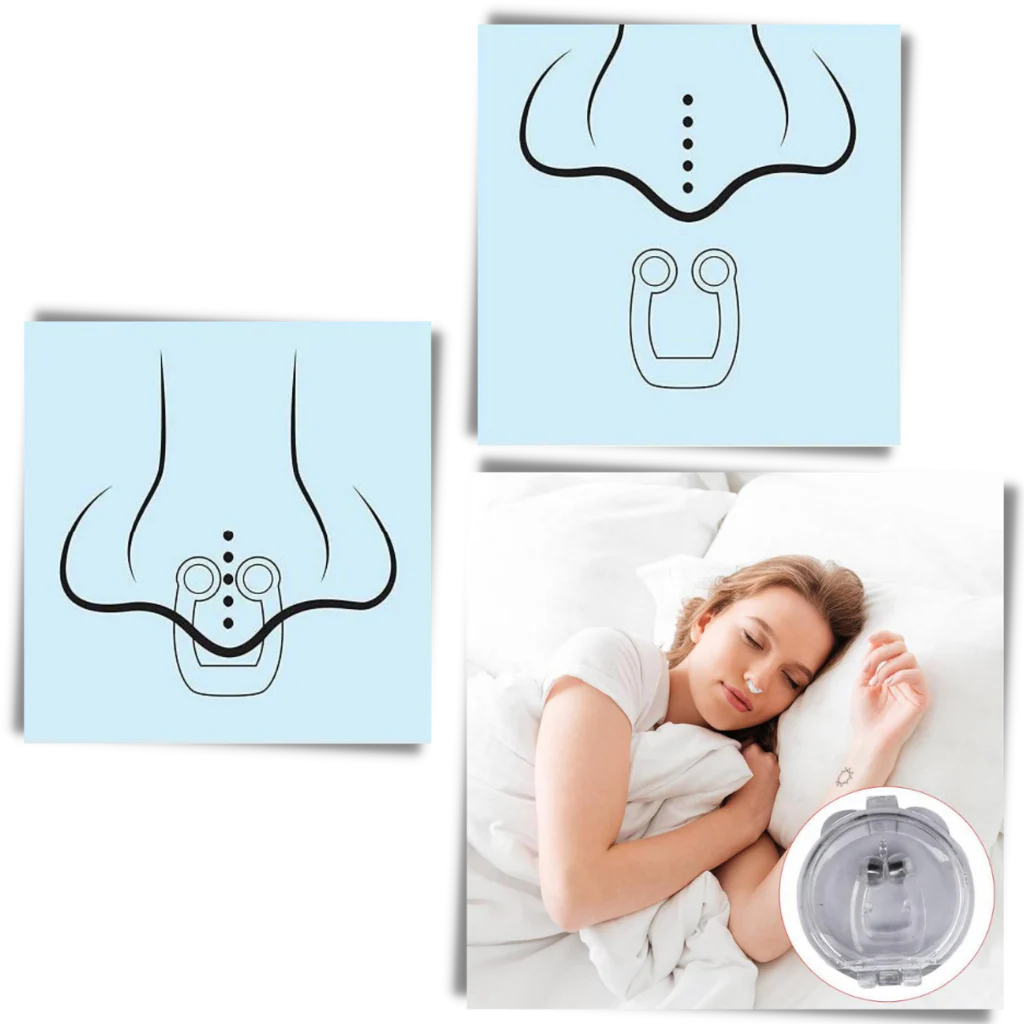 Anti-Snoring Nasal Device - Image 4