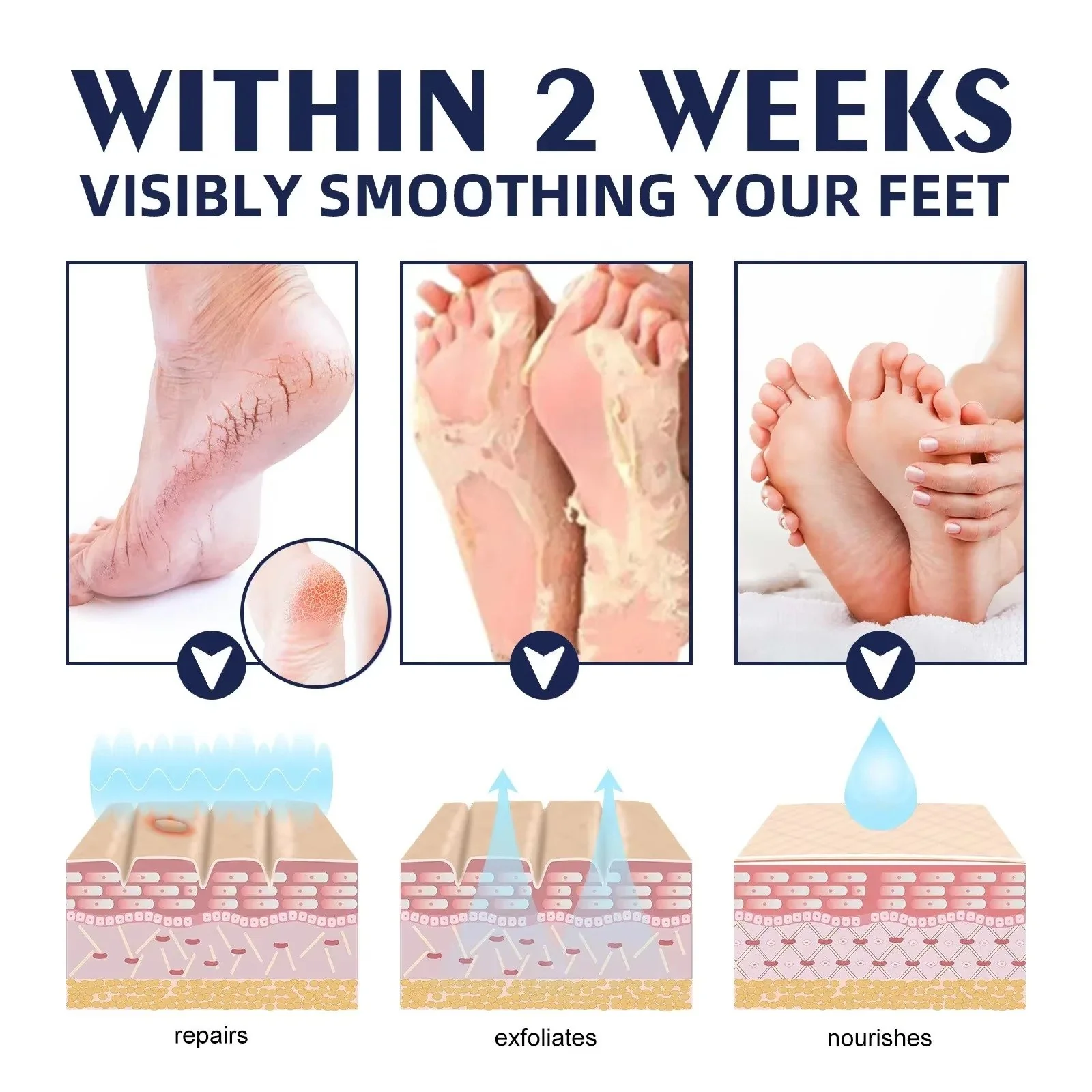 Cracked Foot Heel Treatment 3 Pack - Image 6