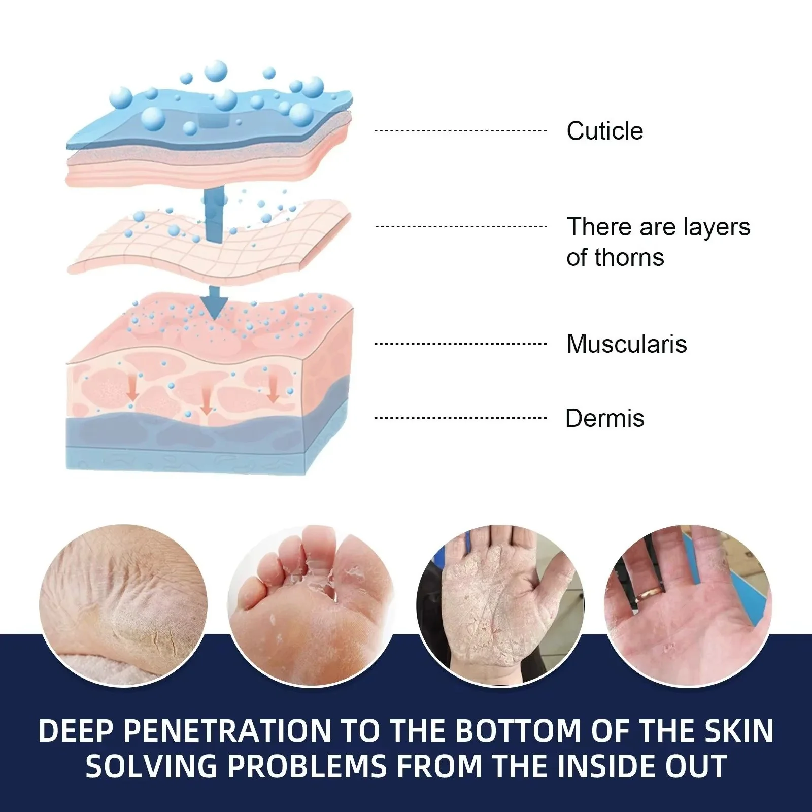 Cracked Foot Heel Treatment 3 Pack - Image 8