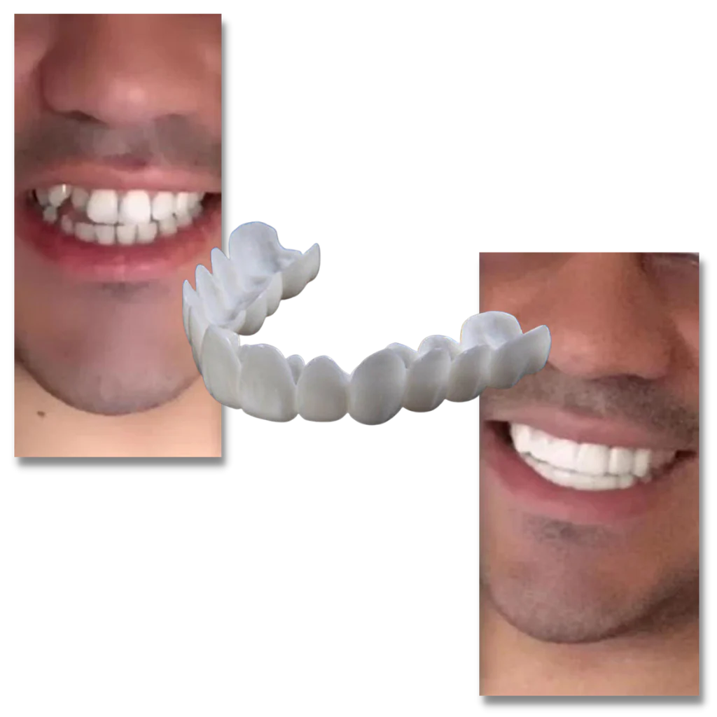 Dental coverage for a perfect smile - comfortable aligners - Image 3