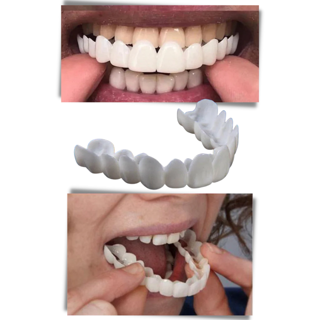 Dental coverage for a perfect smile - comfortable aligners - Image 5