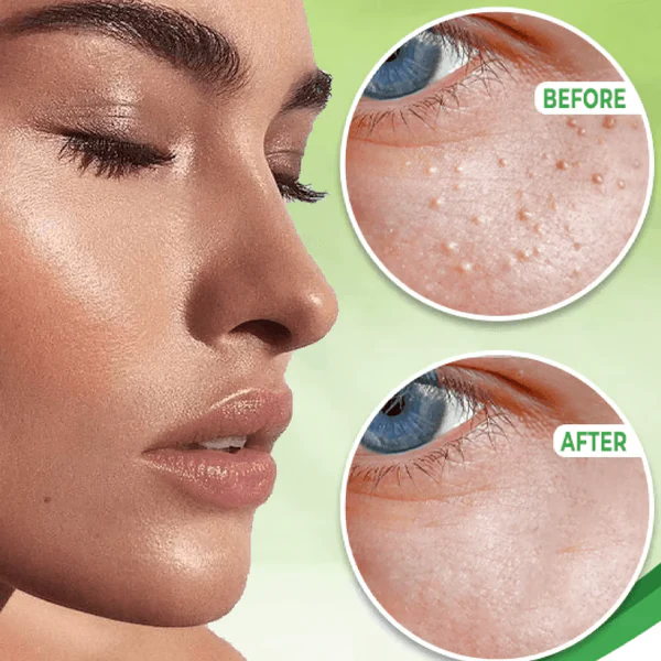 Eye Milia Removal Cream - Image 3