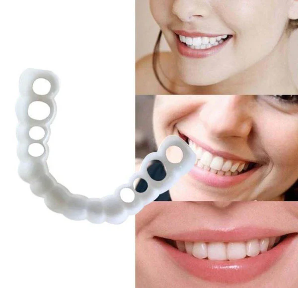 Facial Tooth Cover Retainer - Image 3