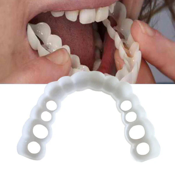 Facial Tooth Cover Retainer - Image 4