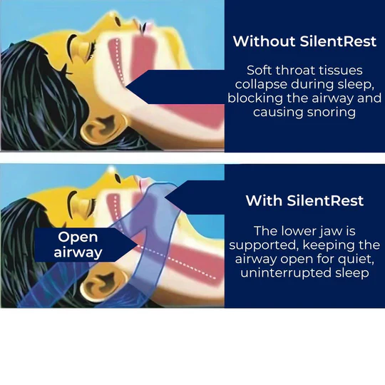 Full Head Chin Strap for Snoring Relief | Sleep Apnea Support - Comfortable - Night Use - Image 7