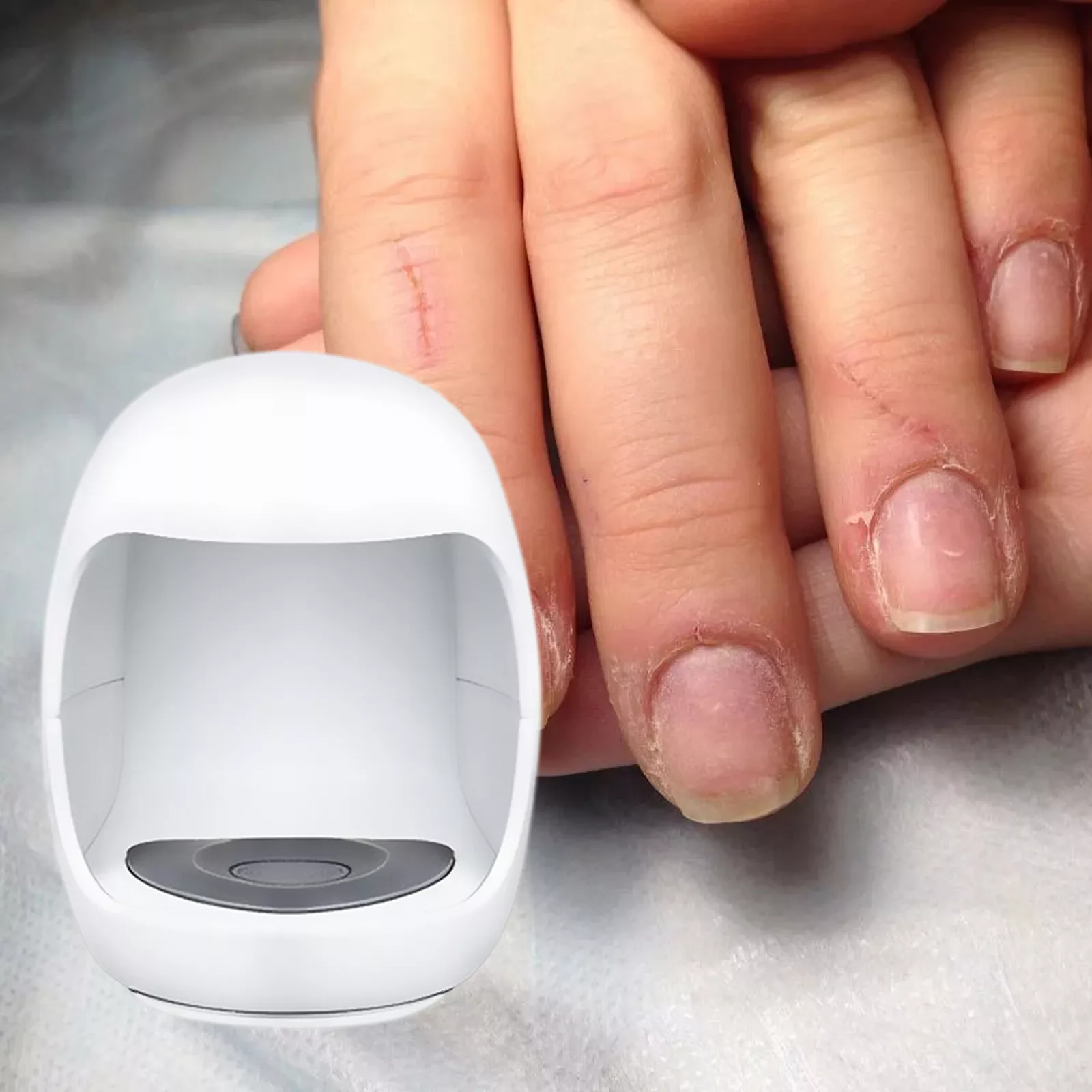 Fungal Laser Toe Treatment Clip On Device - Image 6