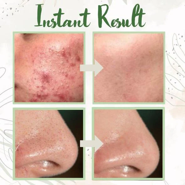 Green Tea Clay Deep Cleanse Mask Stick - Image 7