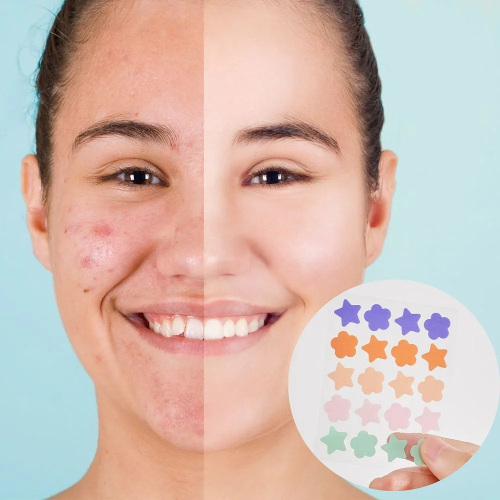 Hydrocolloid Pimple Acne Patch Sticker - Image 2