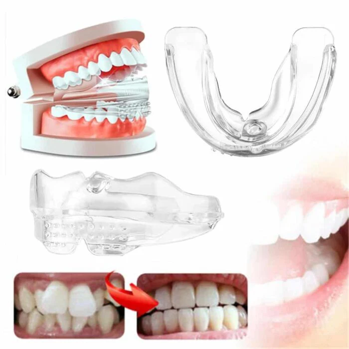 Invisible Dental Realignment Tray - Image 4