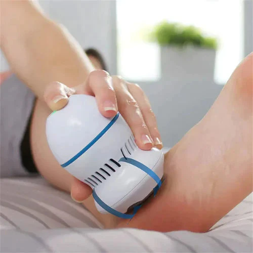 Foot Smoothie - Cracked Heels Treatment - Image 2