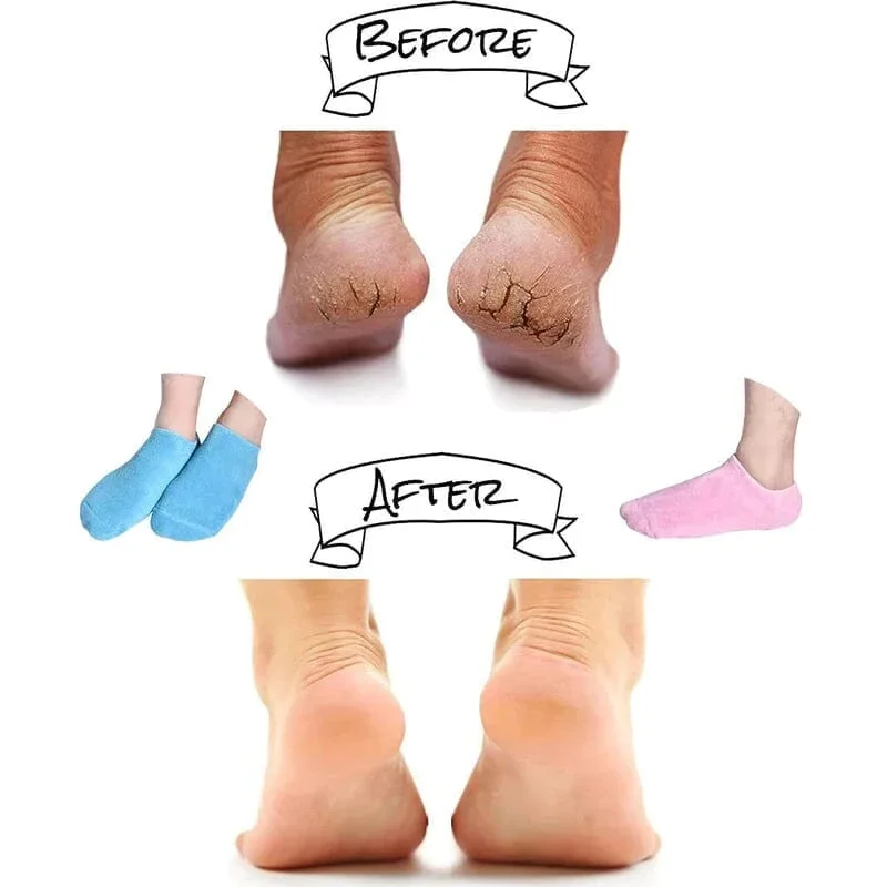 Moisturizing Socks with Spa Gel Lining - Image 14