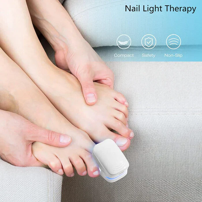 Nail Fungus Cleaning Laser Device - Expert Revolutionary High-Efficiency Light Therapy Device For Toenail Diseases - Image 3