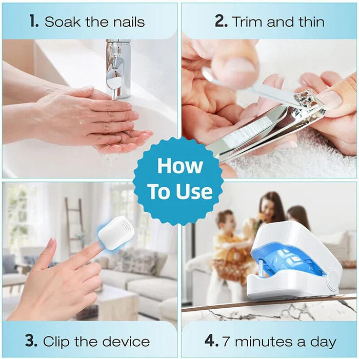 Nail Fungus Cleaning Laser Device - Expert Revolutionary High-Efficiency Light Therapy Device For Toenail Diseases - Image 5