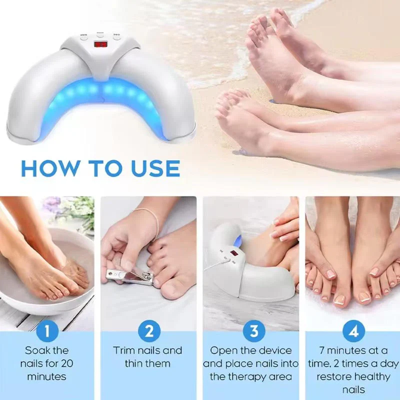 Nail Fungus Laser - Image 7