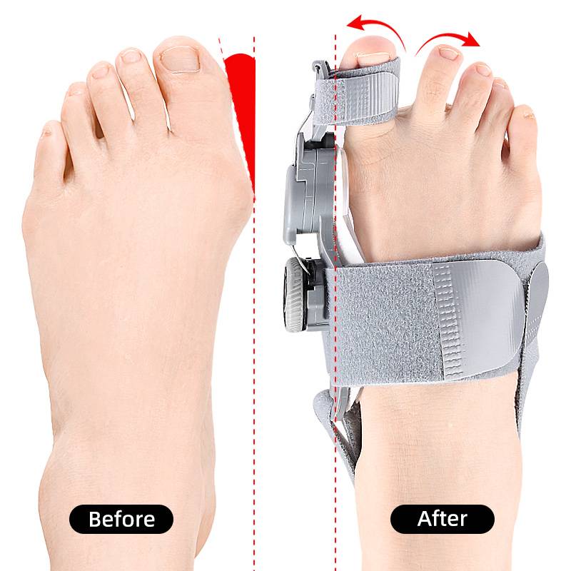 Natural Bunions Corrector Toe Spacer - Image 4