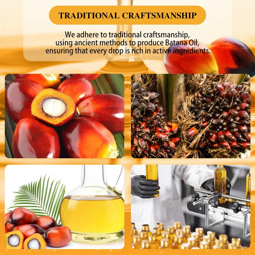 Natural Hair Growth Oil Serum Set - Image 8
