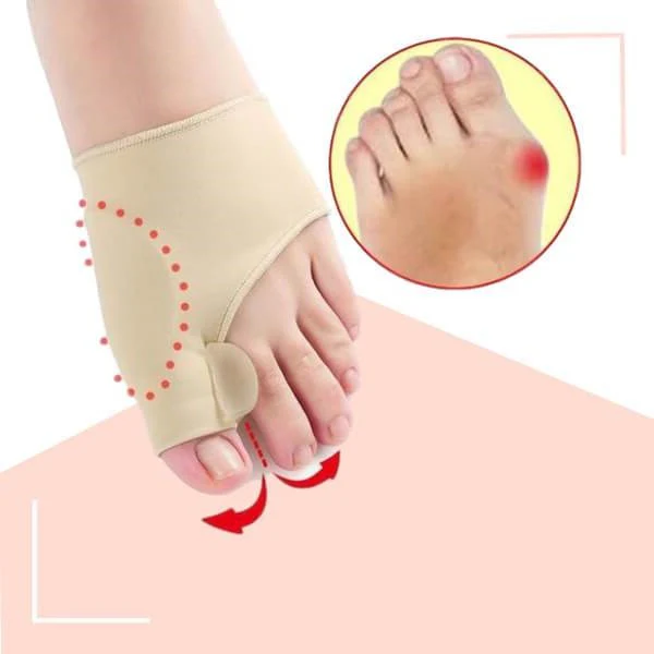 Orthopedic Toe Bunion Corrector - Image 2