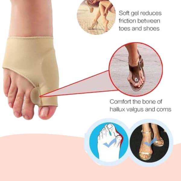 Orthopedic Toe Bunion Corrector - Image 5