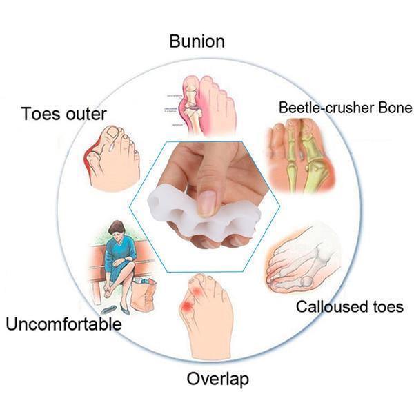 Orthopedic Toe Corrector - Toe Separator - Image 3