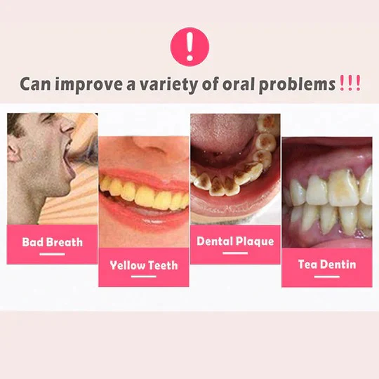 Plaque Remover for Teeth and Gums - Image 3