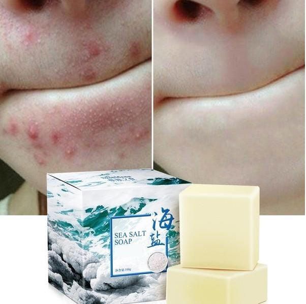 Sea Salt Soap - Acne Treatment - Image 2