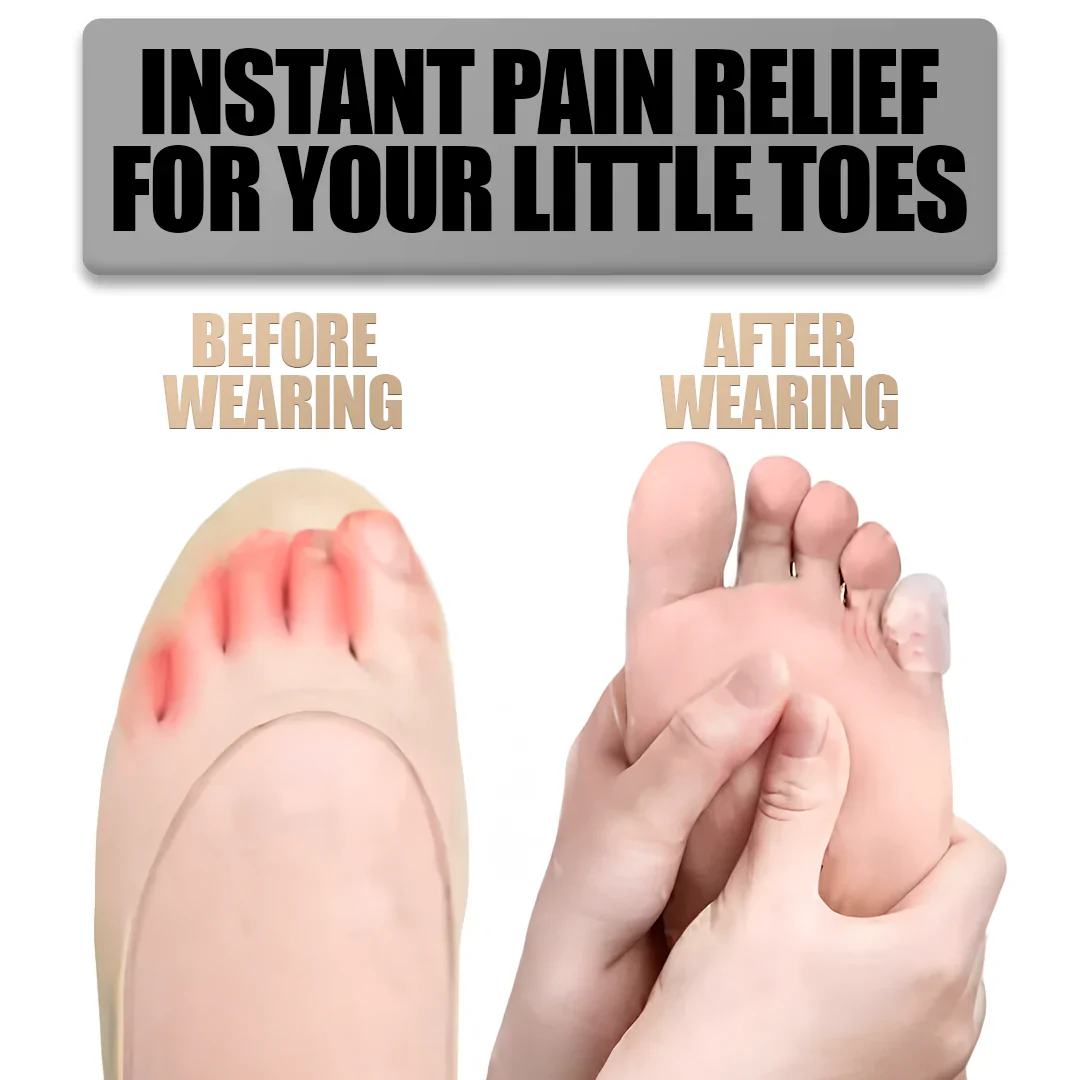 Silicone Anti-Friction Toe Protectors - Image 6