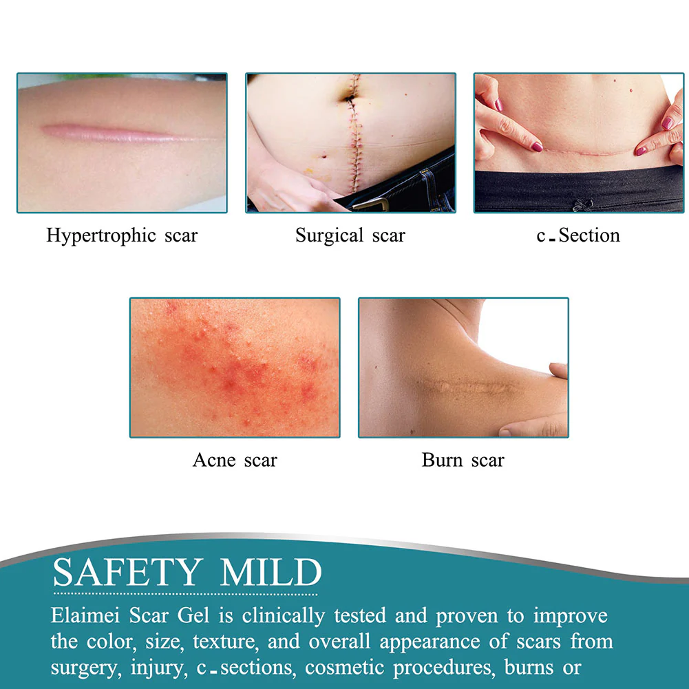 Silicone Scar Tape Roll - Image 6