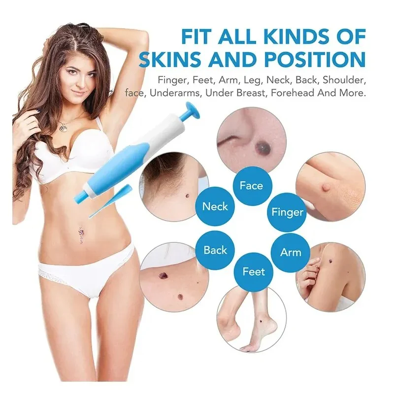 Skin Tag Removal Kit - Image 4