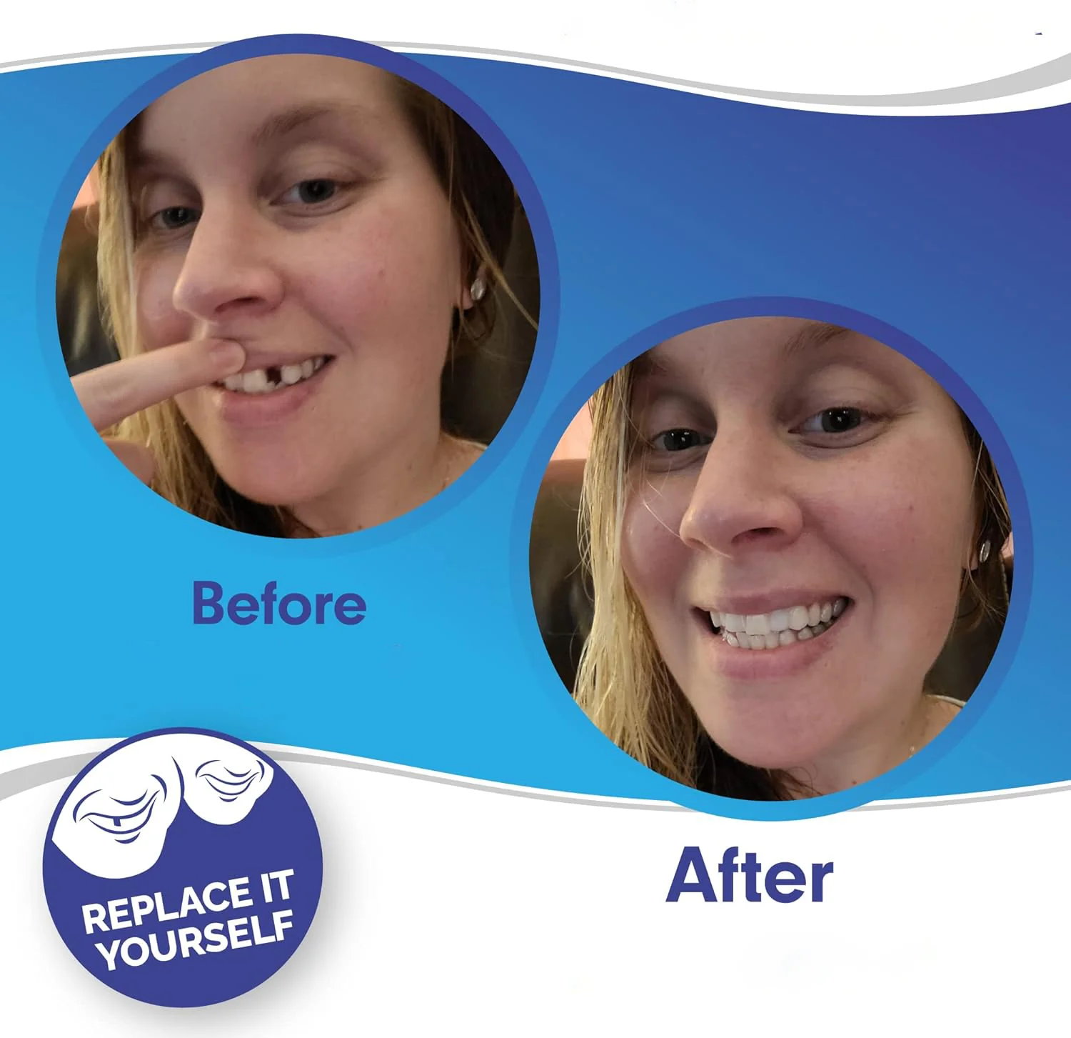 Smile Veneer (Upper & Lower Included) - Image 3