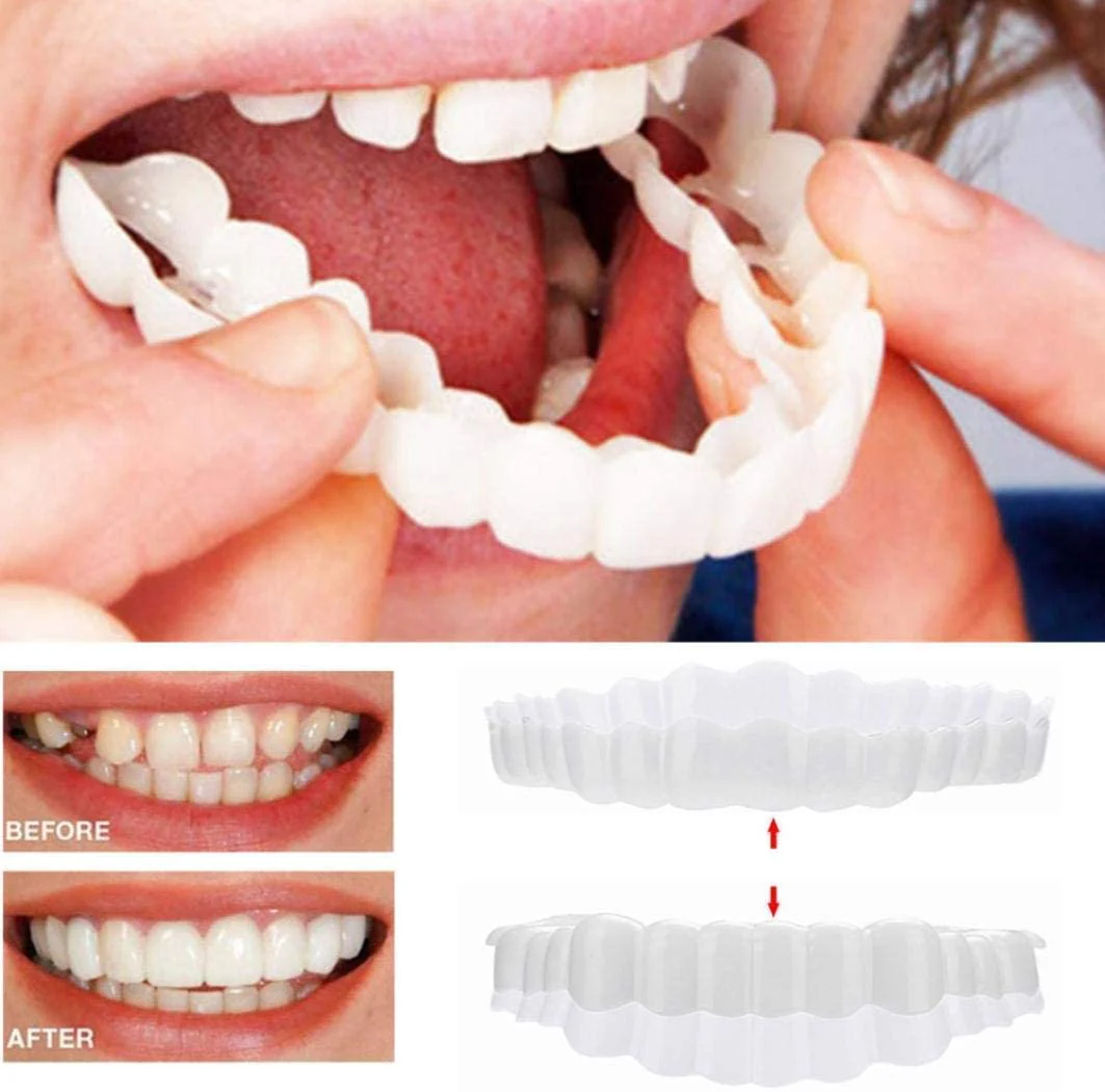 Smile Veneer (Upper & Lower Included) - Image 9