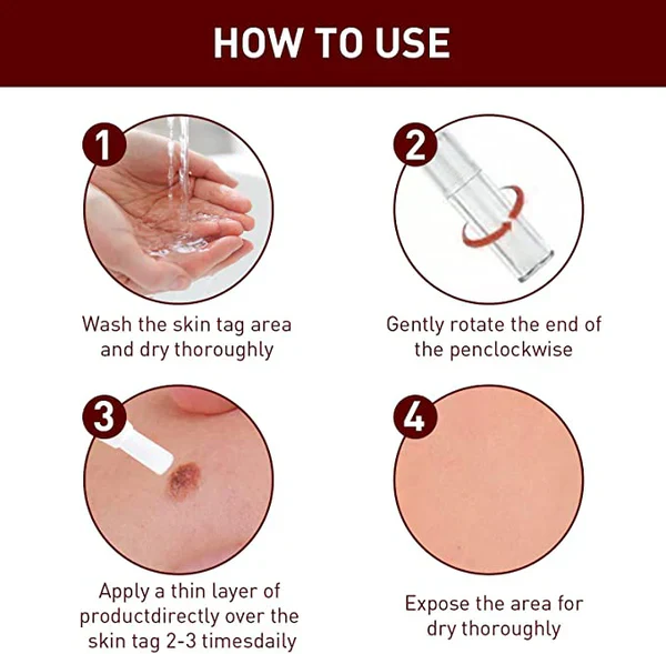Tags & Moles Remover - Image 3