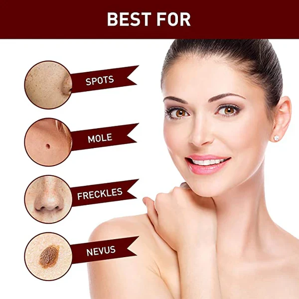 Tags & Moles Remover - Image 7