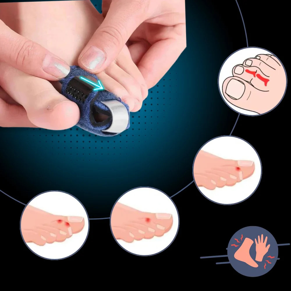 Toe Straightener with Adjustable Support - Image 4