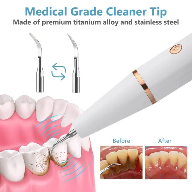 Ultrasonic Scaling Wand: Efficient and safe tooth cleaning at home with LED light and USB quick-charge function - Image 2