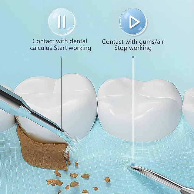 Ultrasonic Scaling Wand: Efficient and safe tooth cleaning at home with LED light and USB quick-charge function - Image 4