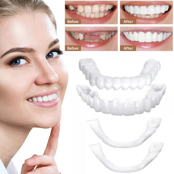 Veneers for Teeth with Natural White Finish - Image 3