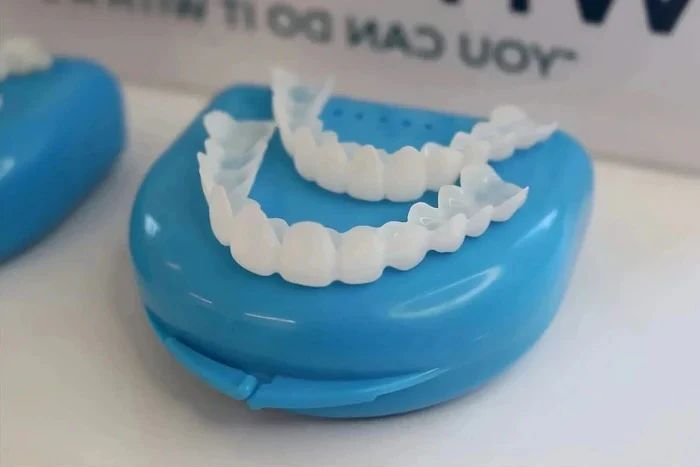 Veneers for Teeth with Natural White Finish - Image 5