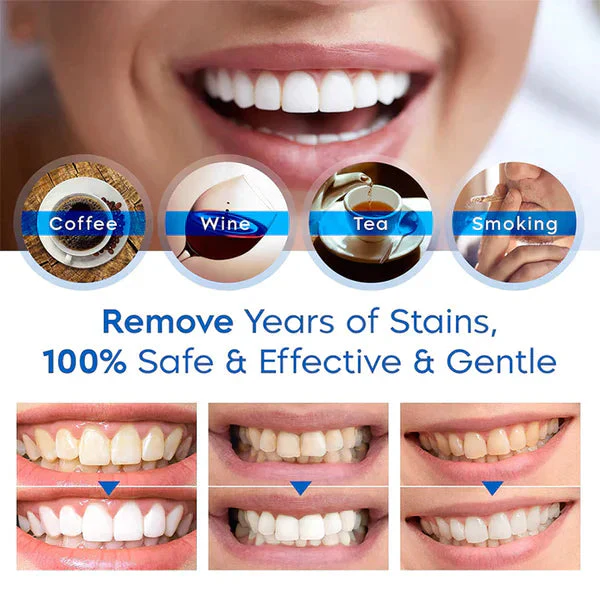 Teeth Whitening Essence Pen - Image 3